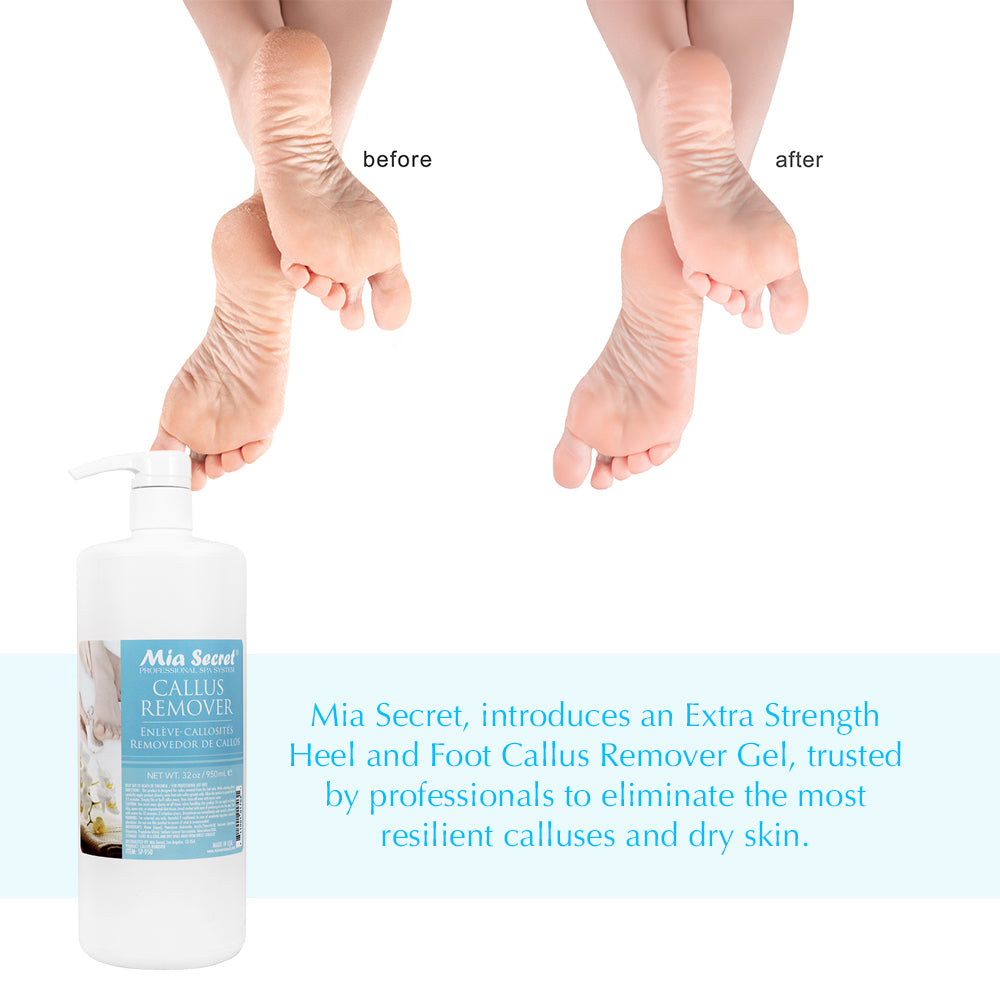 Callus Remover